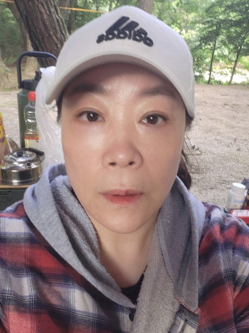 中年眼部整形3种：自然最重要！ 사진 7