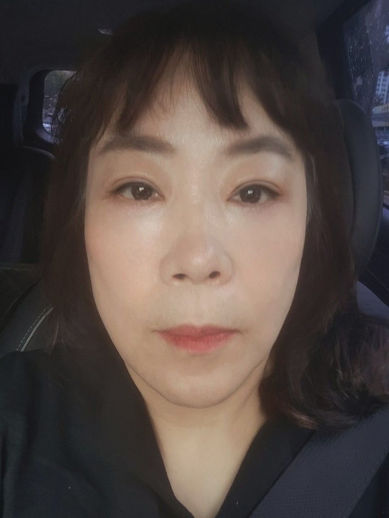 中年眼部整形3种：自然最重要！ 사진 6
