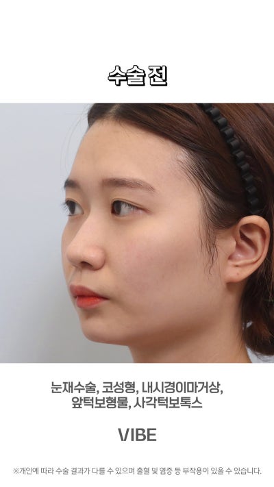 VIBE 整形外科的完美變身!短片! 사진 9