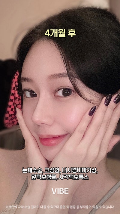 VIBE 整形外科的完美變身!短片! 사진 4