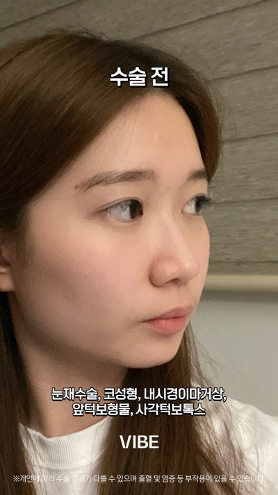 VIBE 整形外科的完美變身!短片! 사진 5