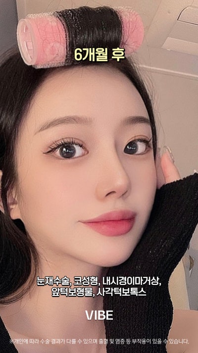 VIBE 整形外科的完美變身!短片! 사진 6