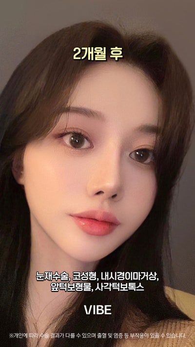 VIBE 整形外科的完美變身!短片! 사진 2