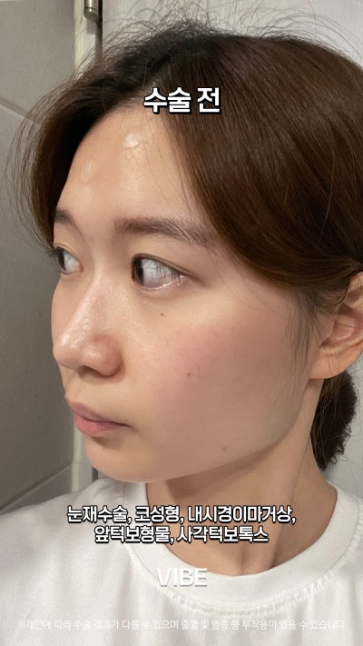 VIBE 整形外科的完美變身!短片! 사진 3