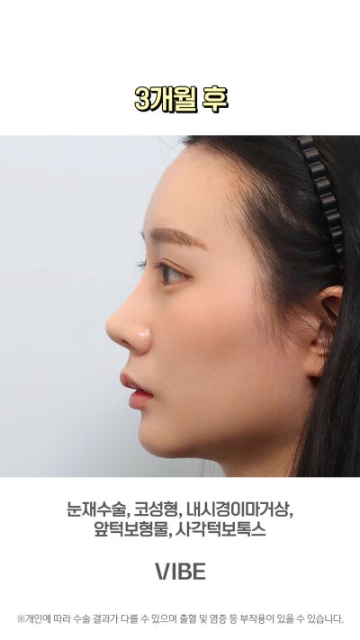 VIBE 整形外科的完美變身!短片! 사진 12