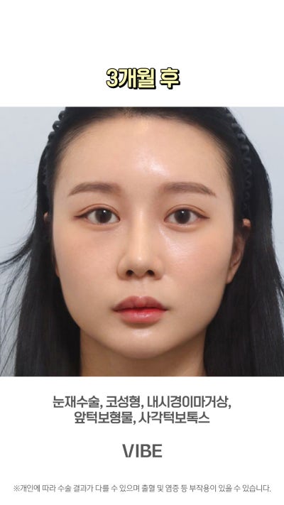 VIBE 整形外科的完美變身!短片! 사진 8