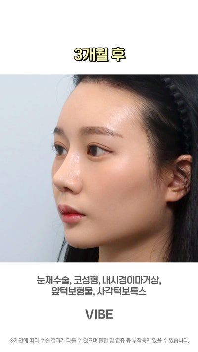 VIBE 整形外科的完美變身!短片! 사진 10