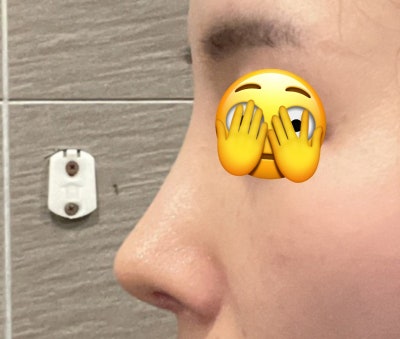 鷹鉤鼻的自然柔美變化?! 사진 8