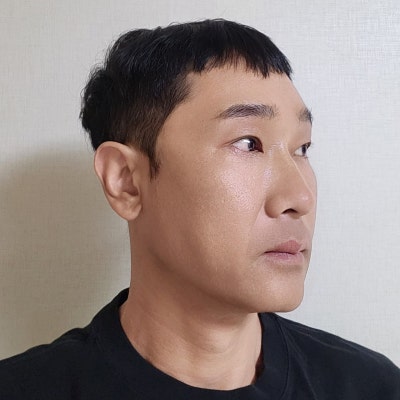 熟男眼部整形:戲劇性且自然的轉變 by 新論峴站 VIBE 整形外科 柳英文院長 사진 6
